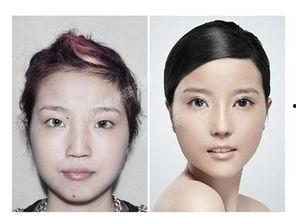 成都医疗整形爆料事件最新,揭秘行业乱象，患者权益如何保障？